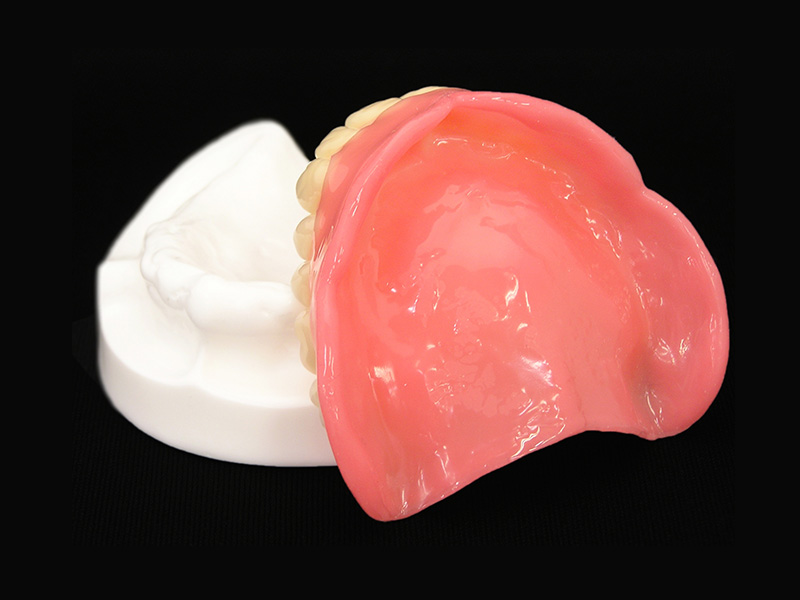 患者様に適した義歯・入れ歯をご提案